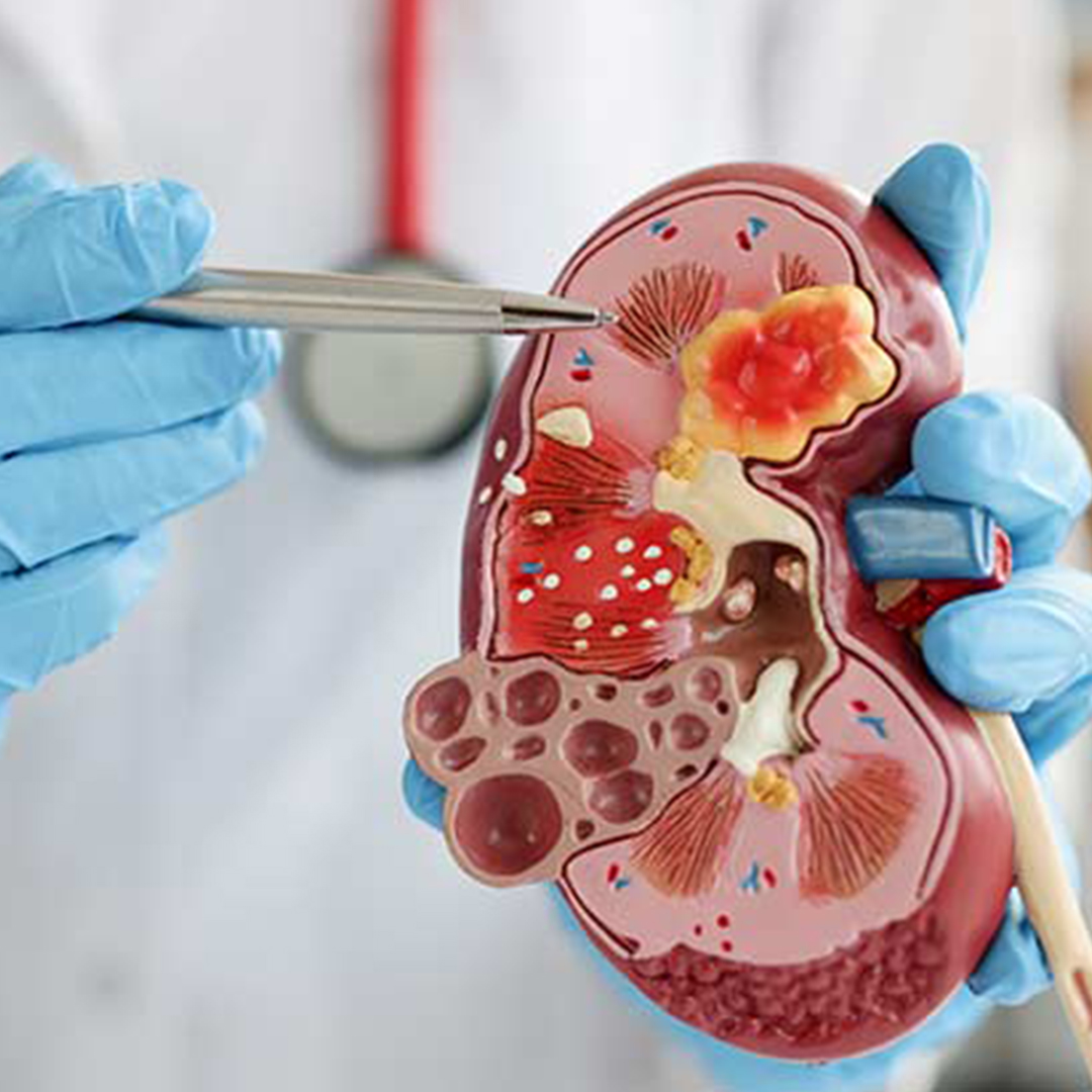 Nephrology Image